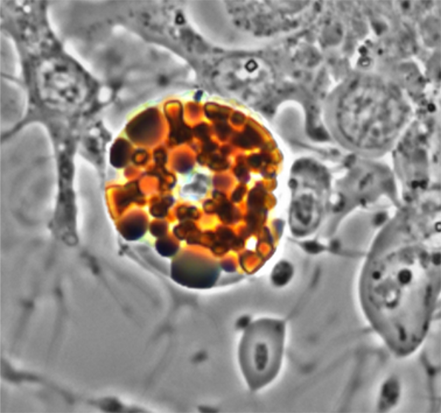 Red spherule cell