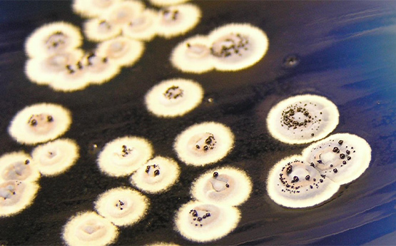 Colonies of Streptomyces producing a blue antibiotic