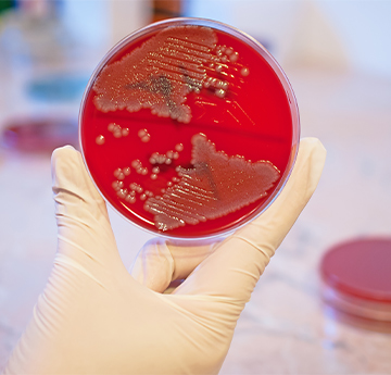 Campylobacter colonies on petri dish