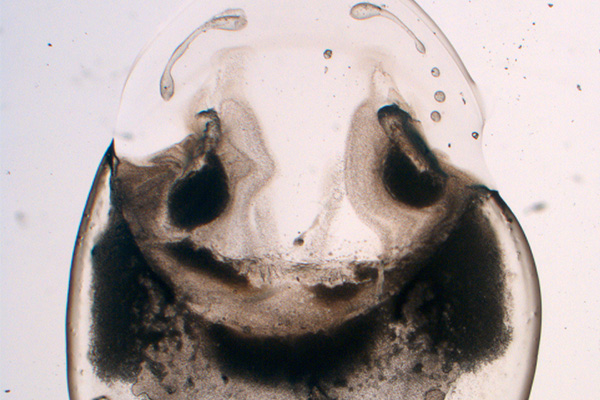 A microscopic image which looks like a sad face
