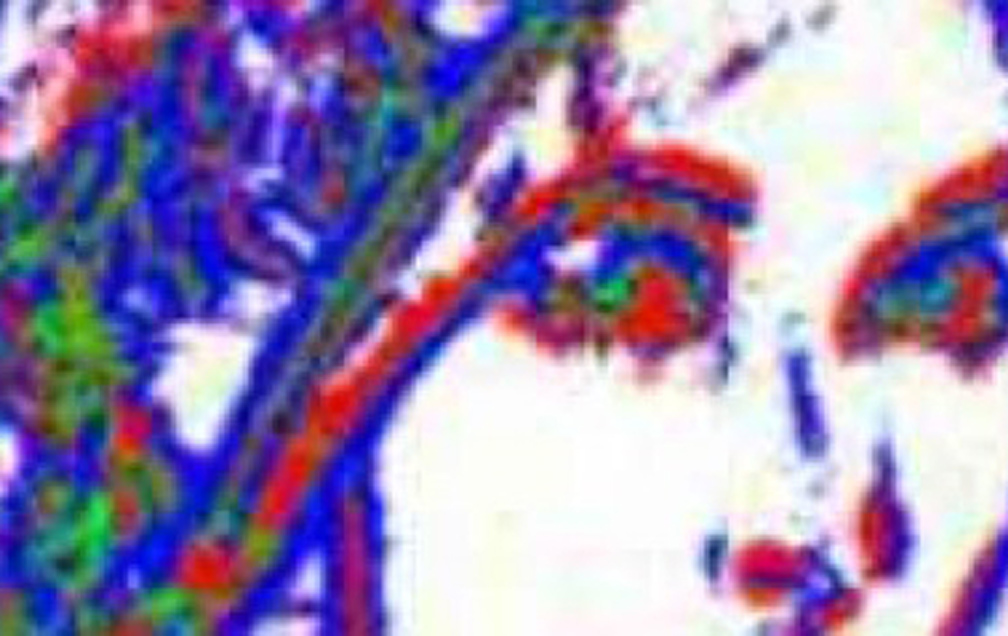 Noise removal, image of a face