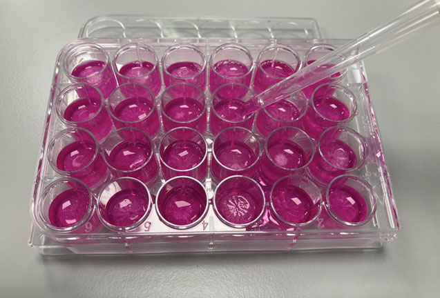 pink liquid in several test tubes as part of cell culture experiment