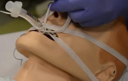 the head of a medical dummy with mouth open and a tape-secured endotracheal tube in place