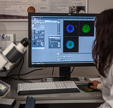 Student on microscope with PC image of slide