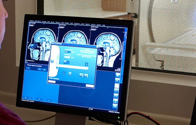 Blue brain scan on a computer screen